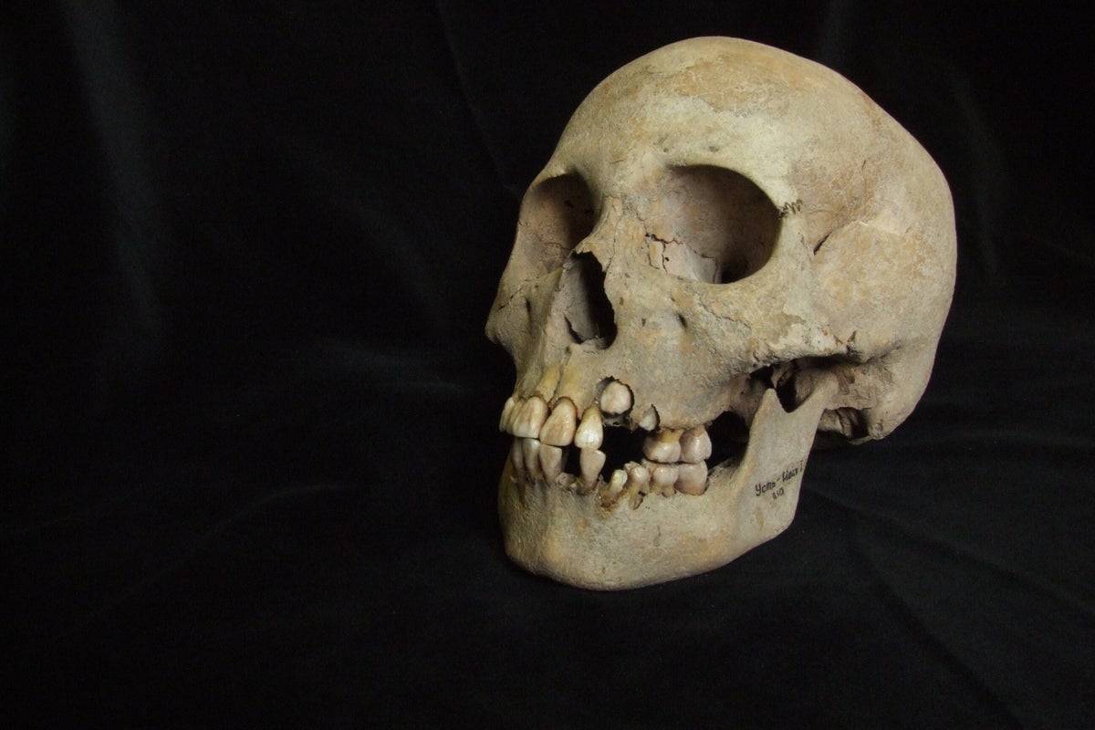 Ancient DNA rewrites plague history after deadly outbreaks found 5,500 years ago