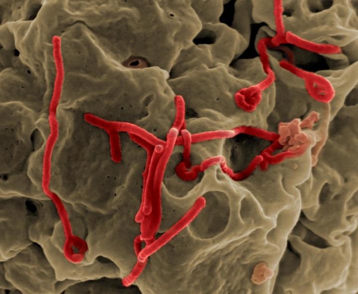 Ebola virus isolated from patient blood samples