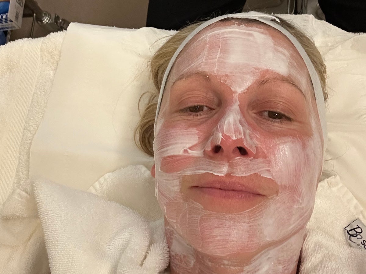 ghk cu peptide reddit results GHK-Cu 6 week before and after : r/Biohackers