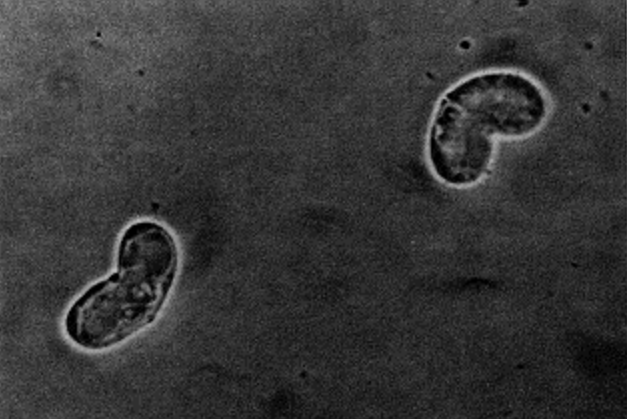 Ceratonova shasta infects salmon and causes hemorrhaging, but also relies on small worms in order to reproduce (USGS)