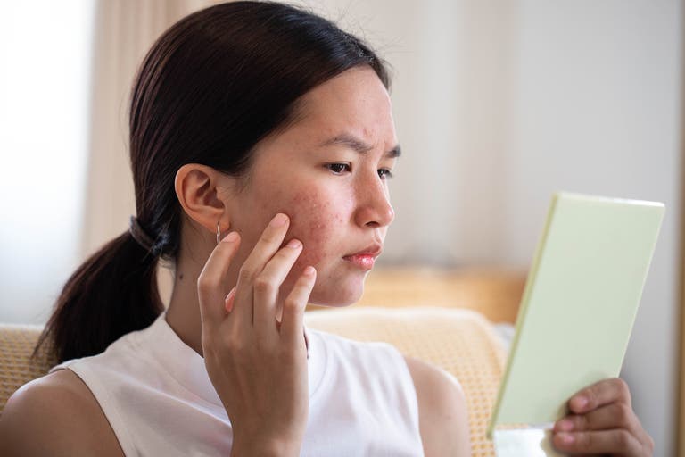 Inositol is one of the most talked-about women’s supplements right now ...
