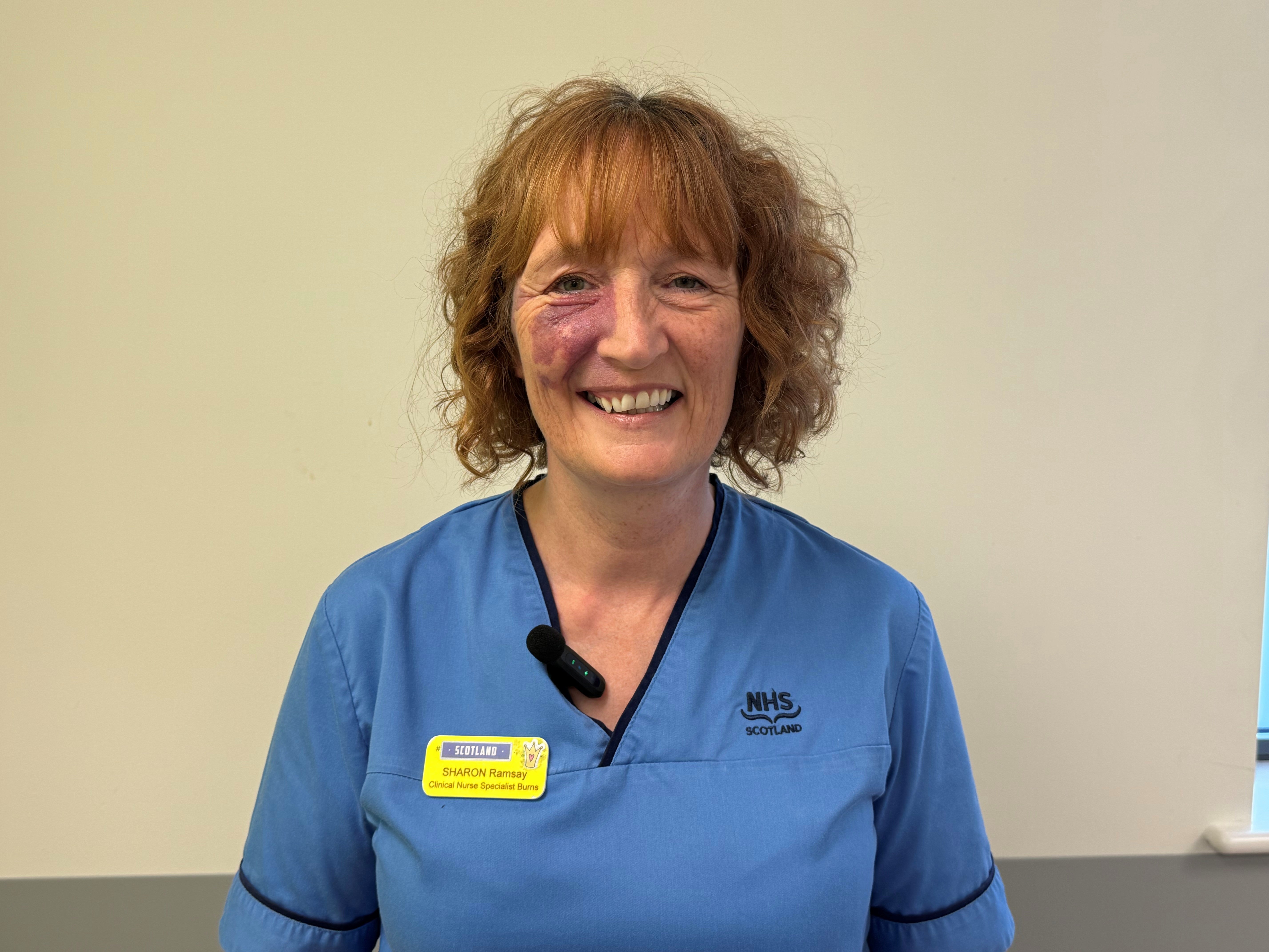 Sharon Ramsay, Burns Nurse at the Royal Hospital for Children, Glasgow