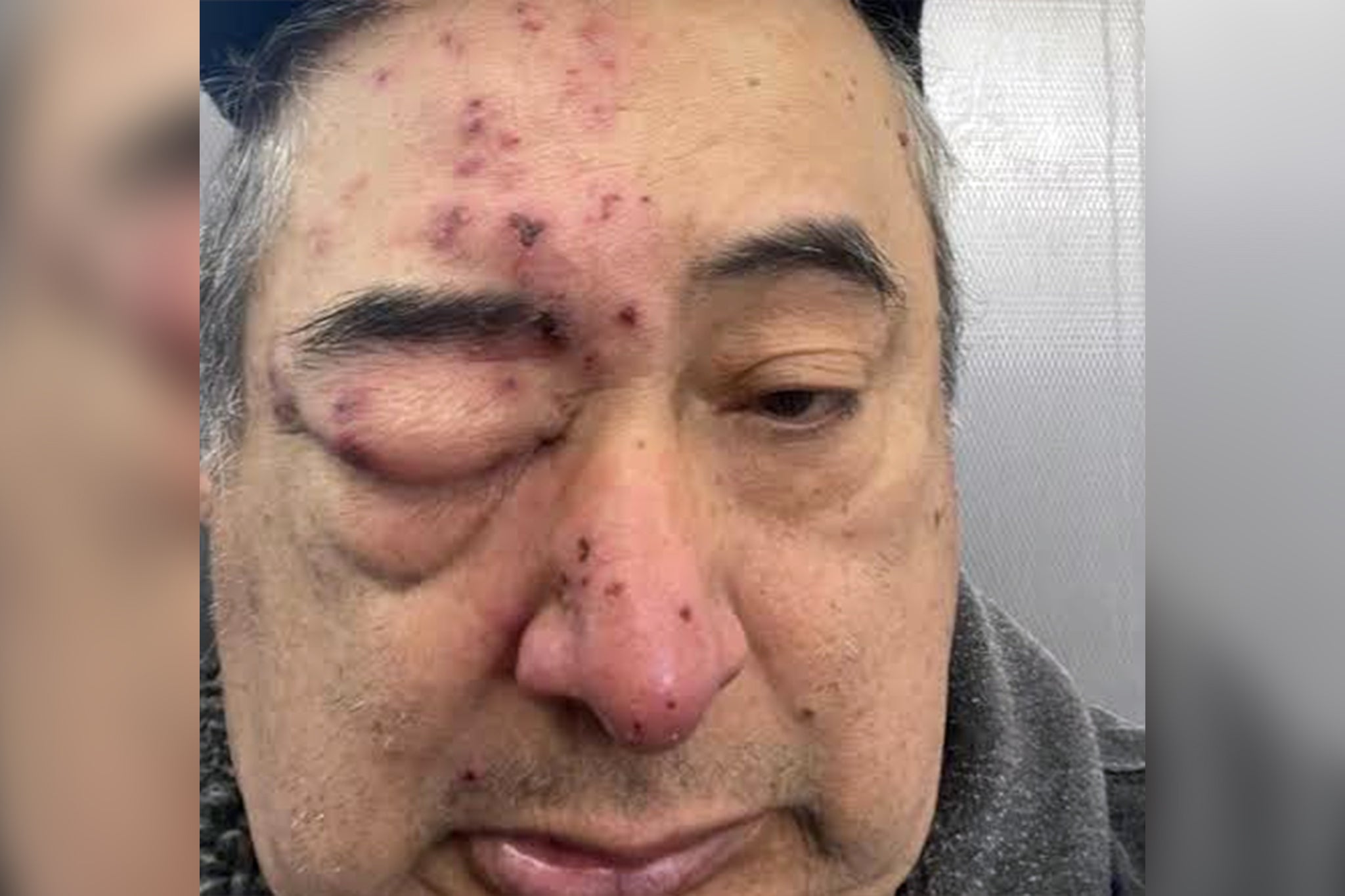 Chicago man woke up in his home with rat ‘chewing on his face’ after complaining about infestation