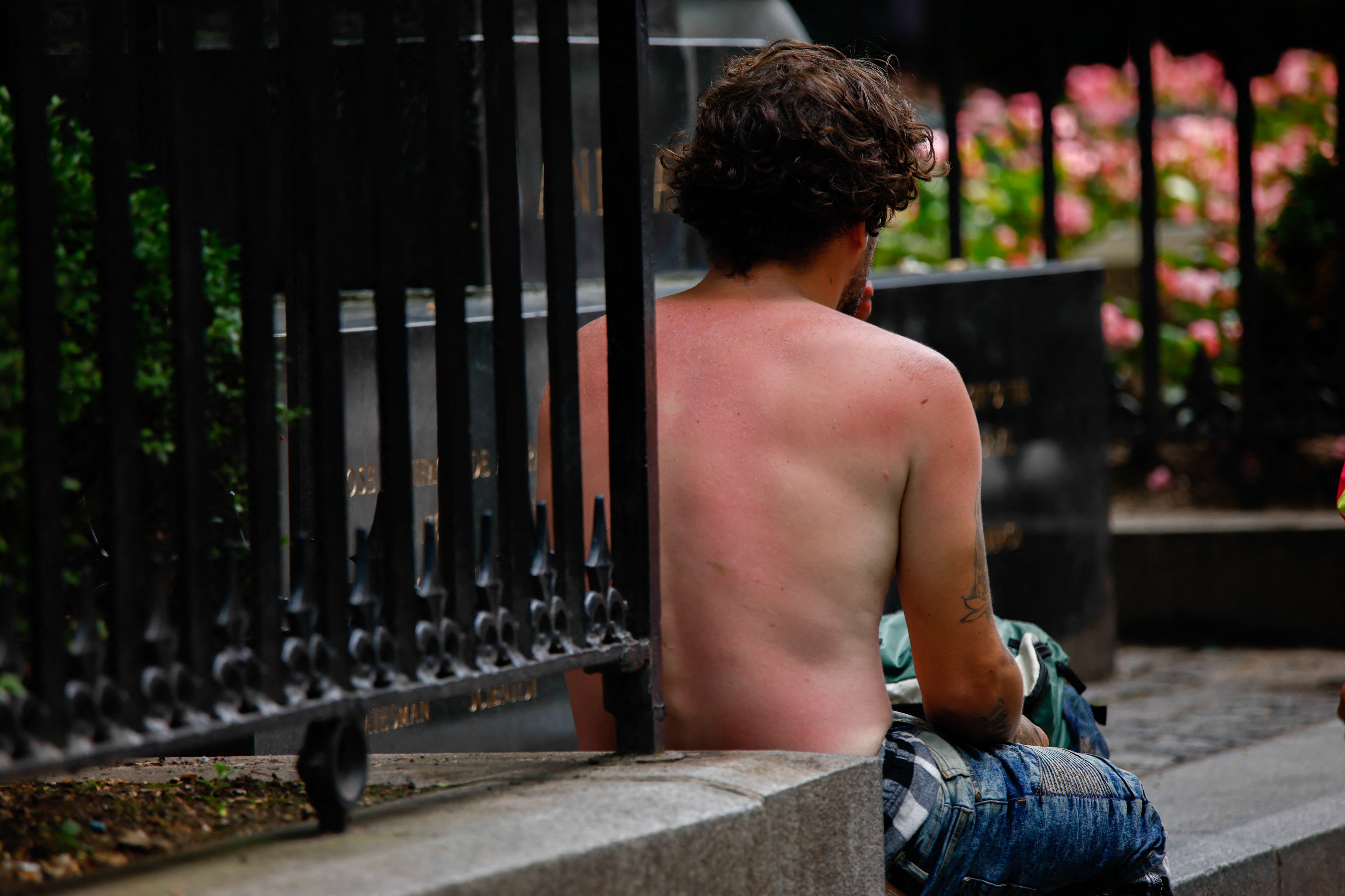 The sunburns that can change your life: Experts say just 5 can double cancer risk – UK Times