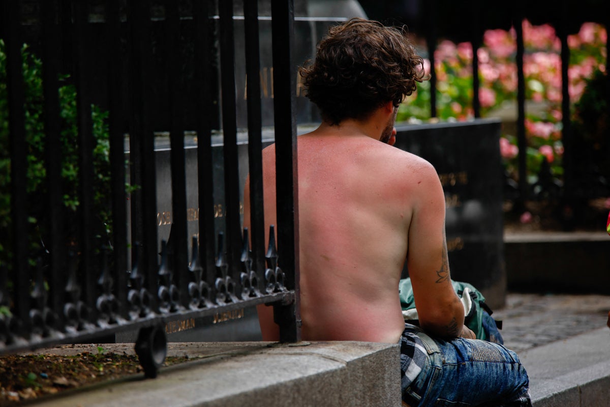 The sunburns that can change your life: Experts say just 5 can double cancer risk – UK Times The sunburns that can change your life: Experts say just 5 can double cancer risk – UK Times