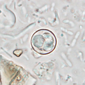 A parasite that causes watery diarrhea has been reported in 145 people across the U.S. this summer, the CDC said