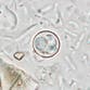 Parasite that causes ‘explosive diarrhea’ is spreading across the US