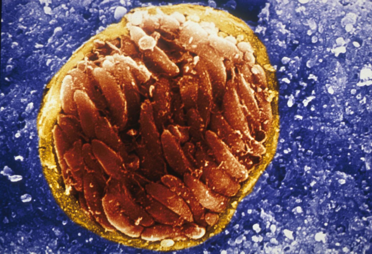 Scanning electron micrograph of the Toxoplasmosis parasite cyst