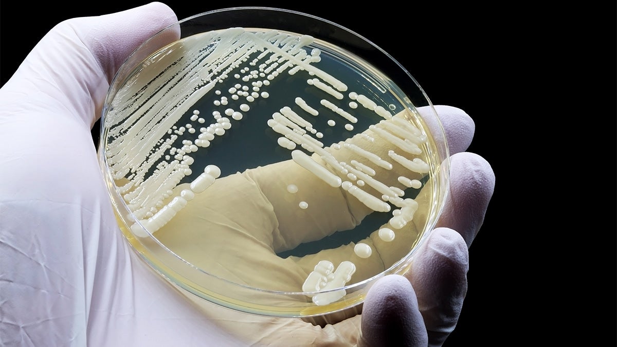 The yeast Candida auris is seen on a petri dish in this photo from the U.S. Centers for Disease Control and Prevention. The CDC warns that exposed to the yeast can spread infections without realizing it