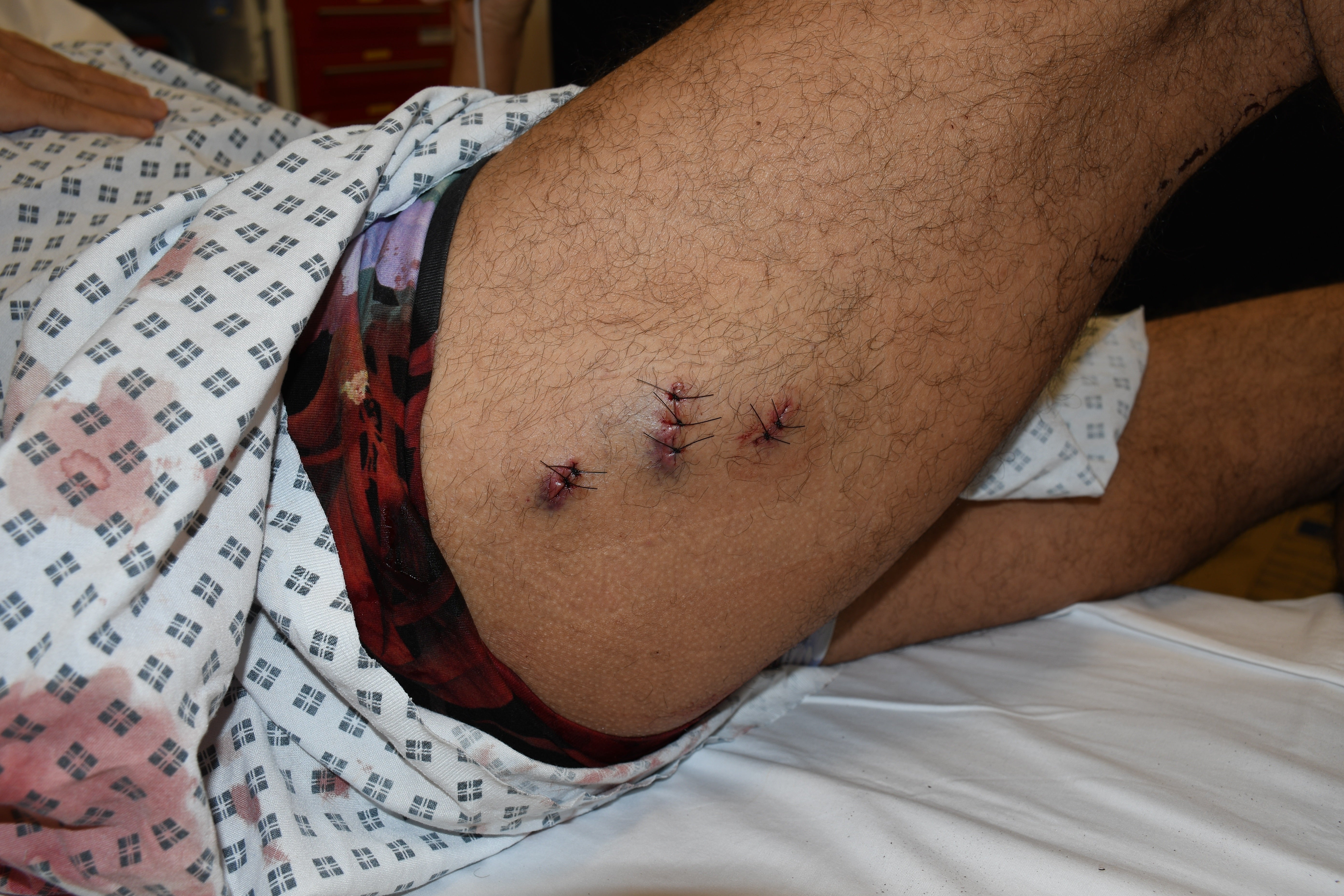 Pouria Zeraati was left bleeding in the street after the attack