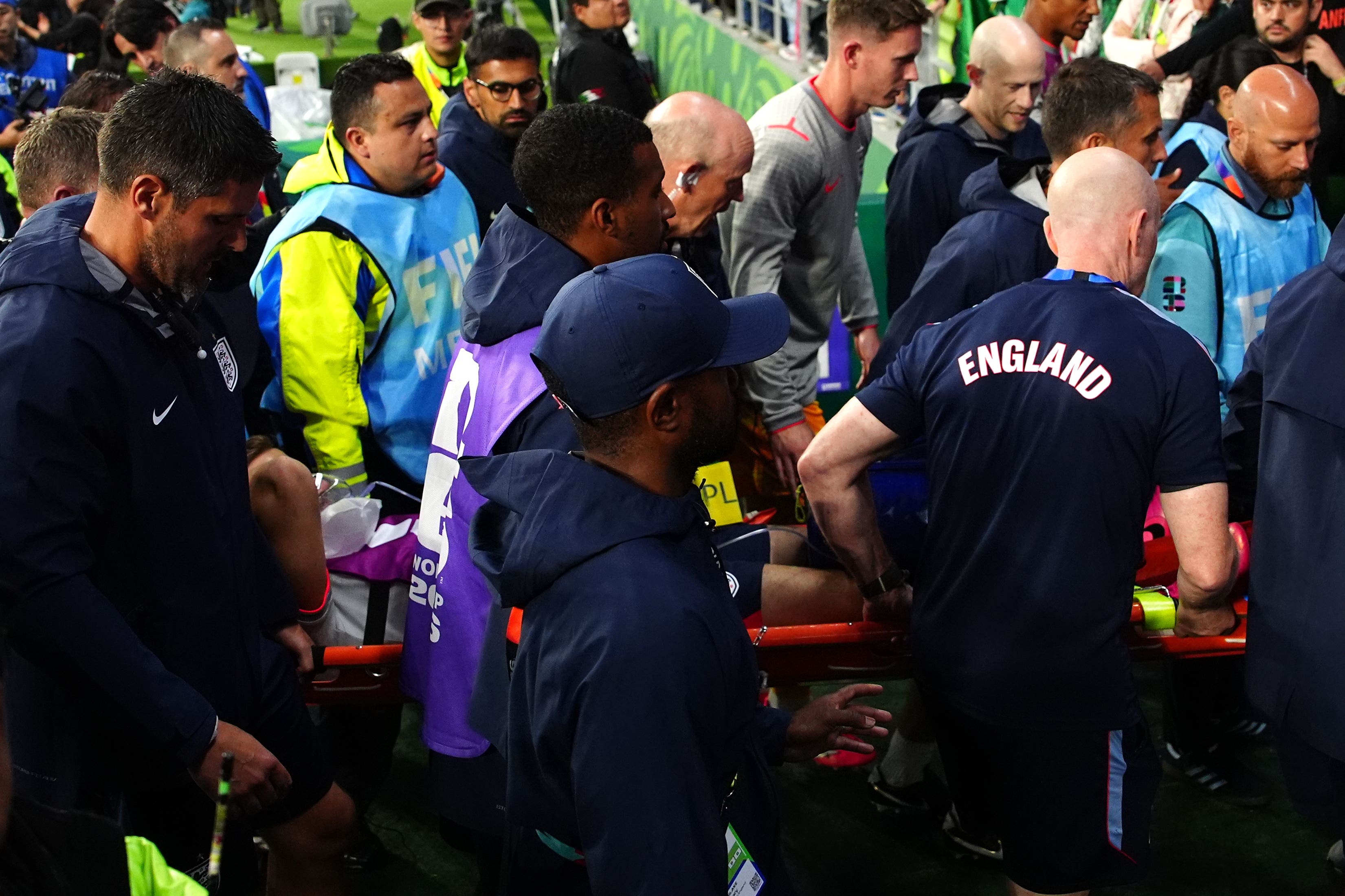 Henderson had to be stretchered off the pitch after breaking is arm