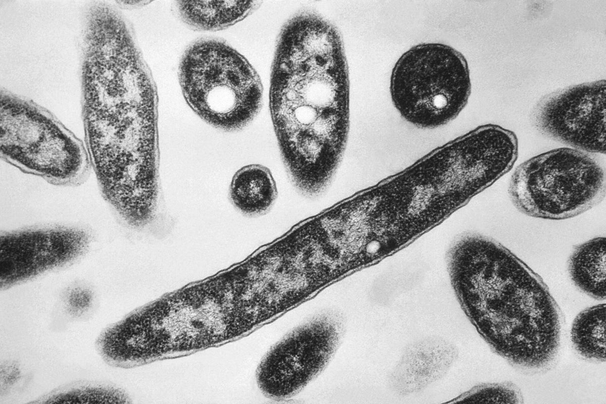 First death reported in Legionnaires’ disease outbreak in New York City – UK Times First death reported in Legionnaires’ disease outbreak in New York City – UK Times