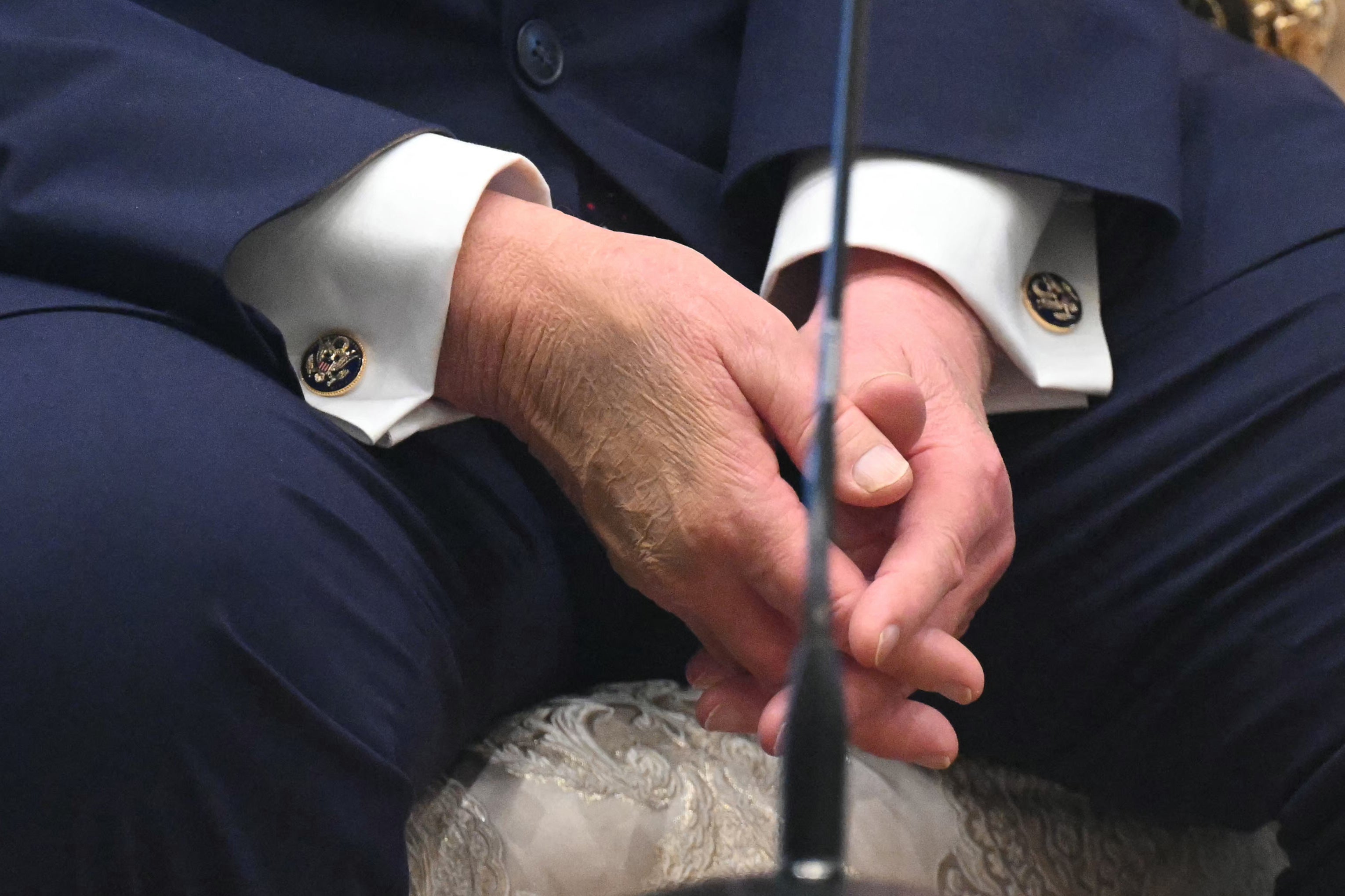President Donald Trump's hand appeared bruised and covered in make-up during his meeting with Turkish President Recep Tayyip Erdogan on Tuesday