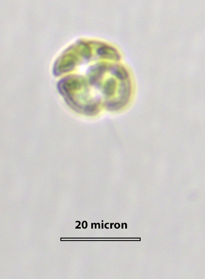 Microalgae under microscope
