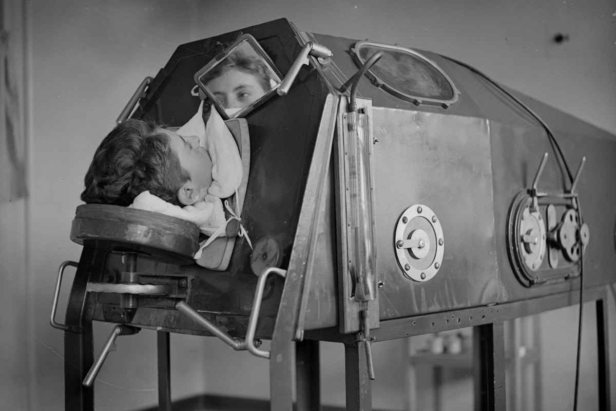 Last US polio patient using an iron lung to survive dies in Oklahoma – UK Times Last US polio patient using an iron lung to survive dies in Oklahoma – UK Times