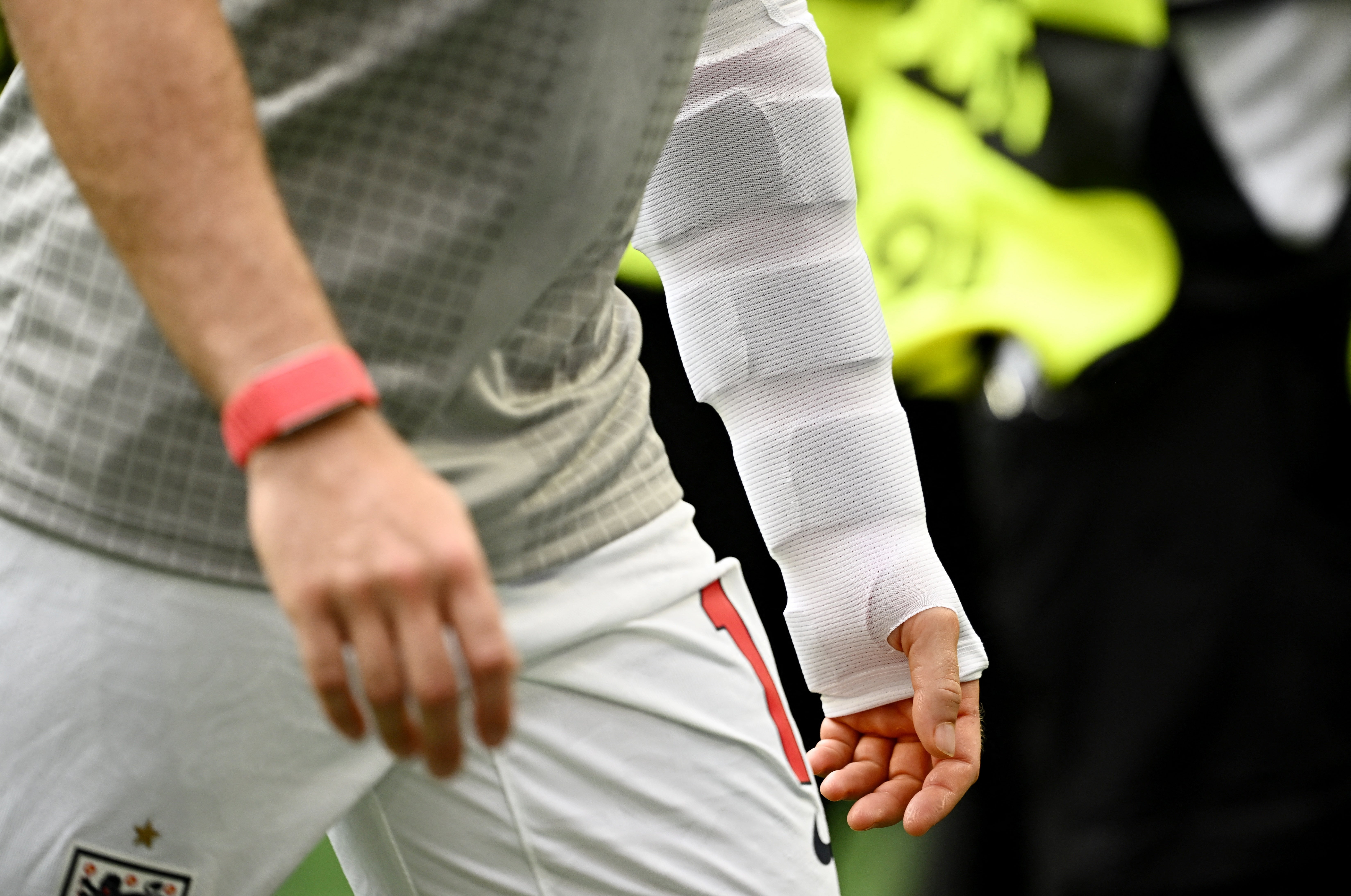 Jordan Henderson's arm in a cast before England's quarter-final against Norway