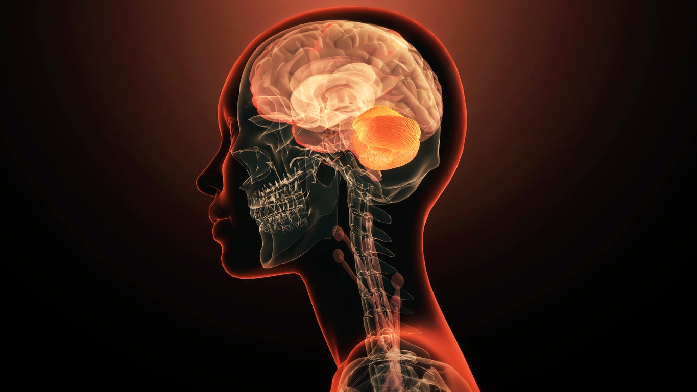 What people with Metabolic Syndrome should know about their brain health