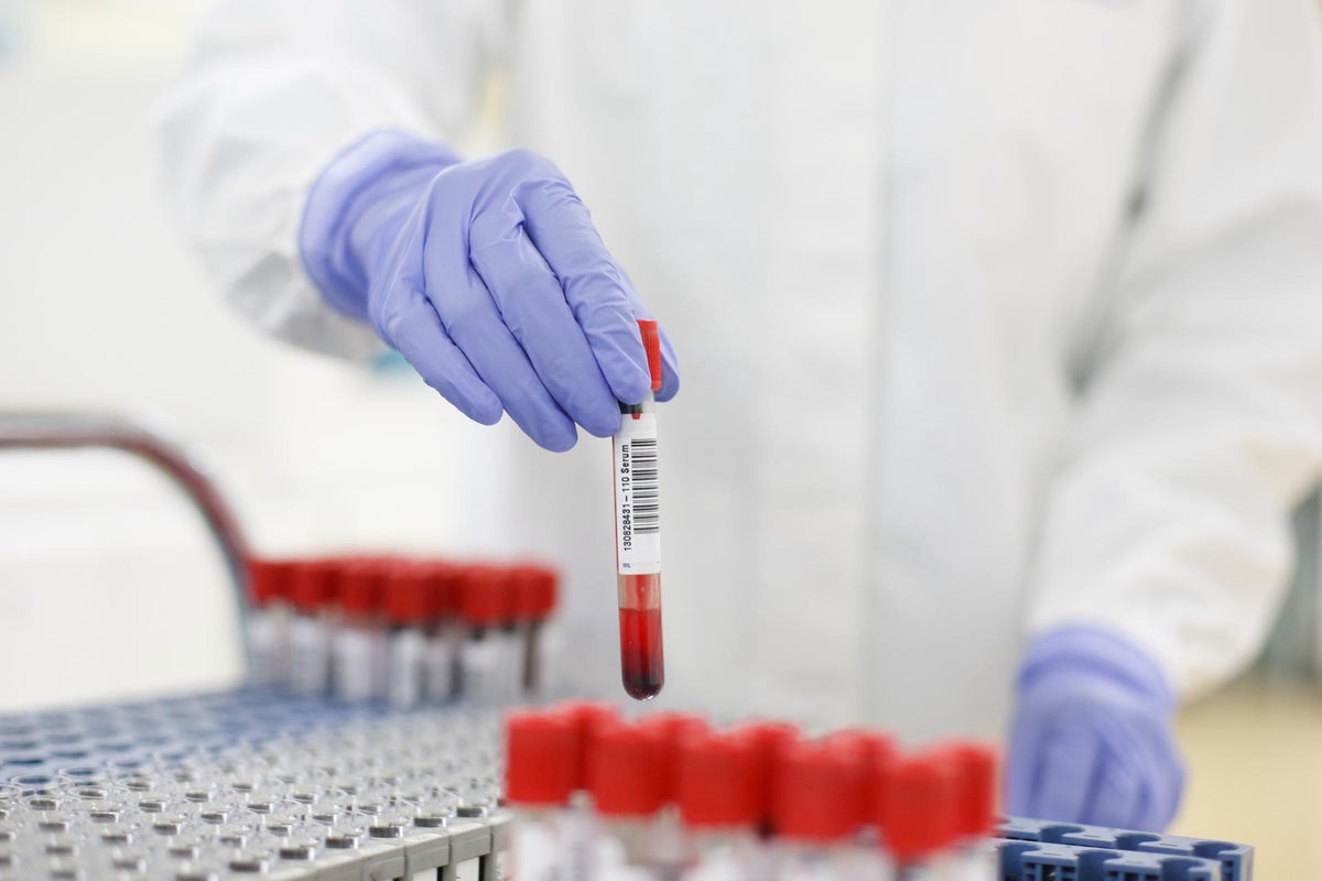 Groundbreaking blood test could detect ‘debilitating’ disease 10 years before symptoms emerge