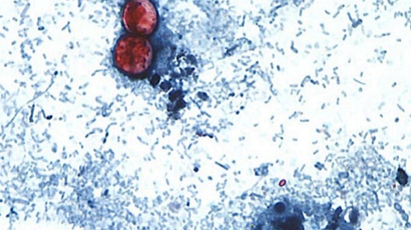The CDC is tracking nearly 7,000 cases of cyclosporiasis — roughly 27 time the level at this point last year — as the gastrointestinal illness spreads across the United States. (CDC)