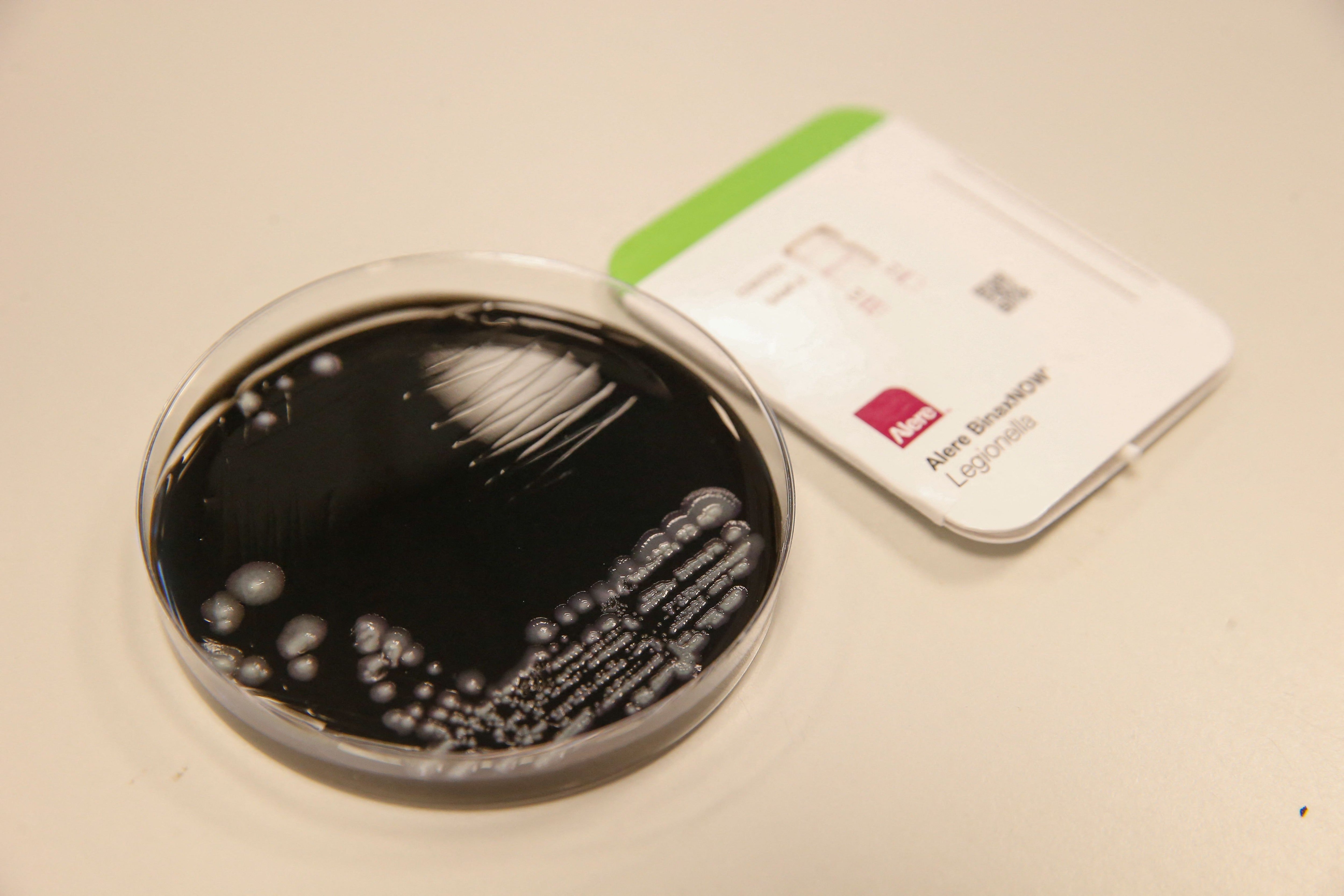 NYC records first Legionnaires’ disease death as cases climb