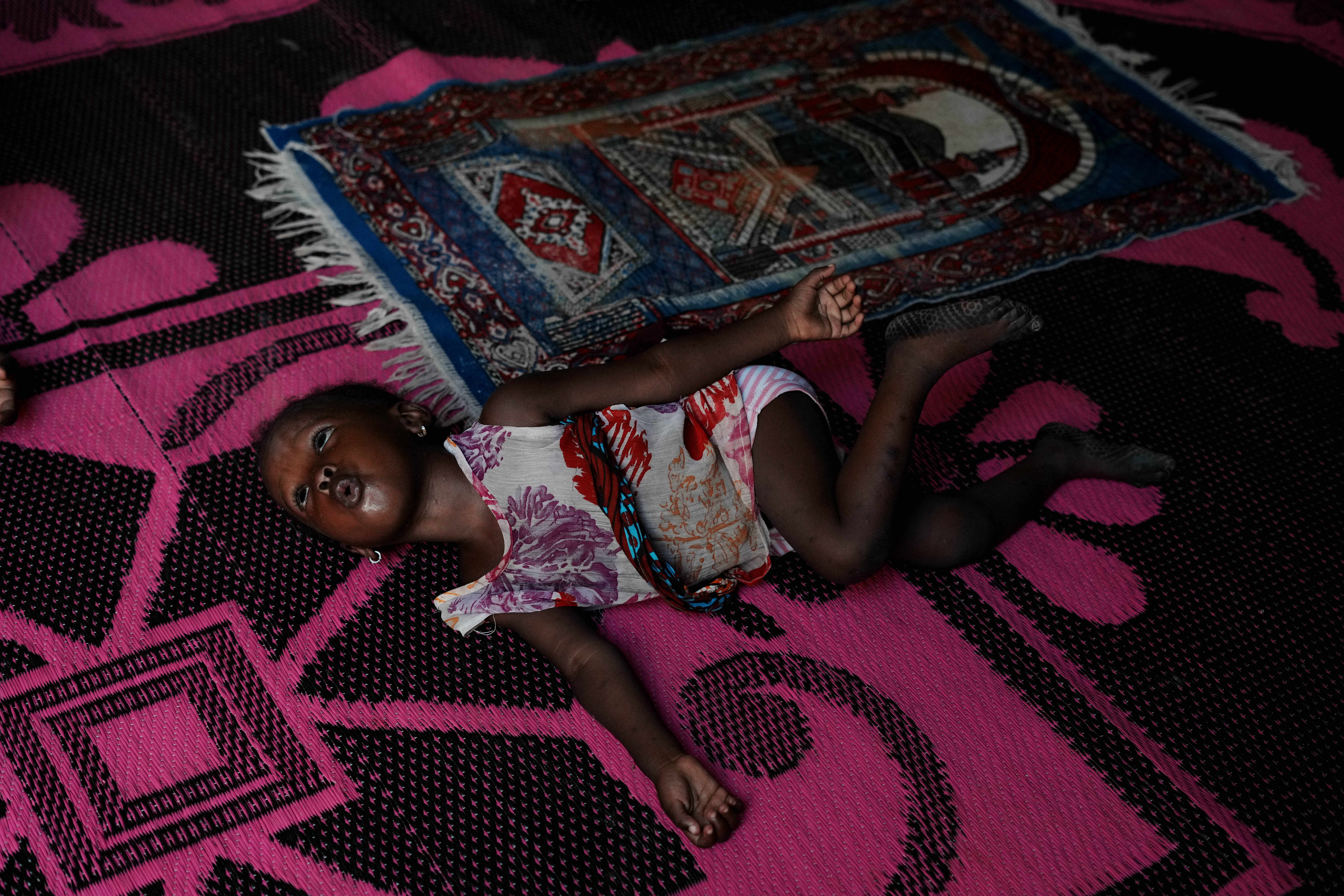 NIGERIA-GUERRA DE IRÁN-MALNUTRICIÓN