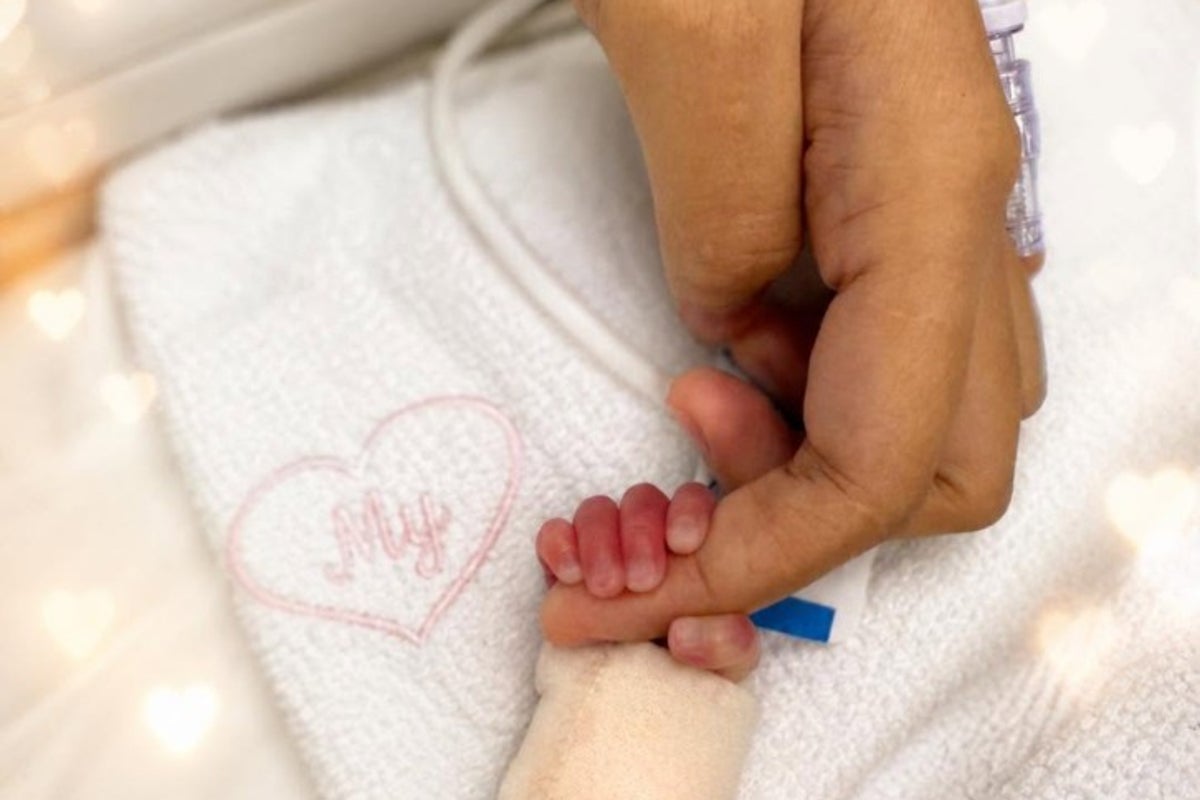 Uma em cada 15 milhões de mulheres dá à luz quadrigêmeos idênticos após a gravidez Uma em cada 15 milhões de mulheres dá à luz quadrigêmeos idênticos após a gravidez