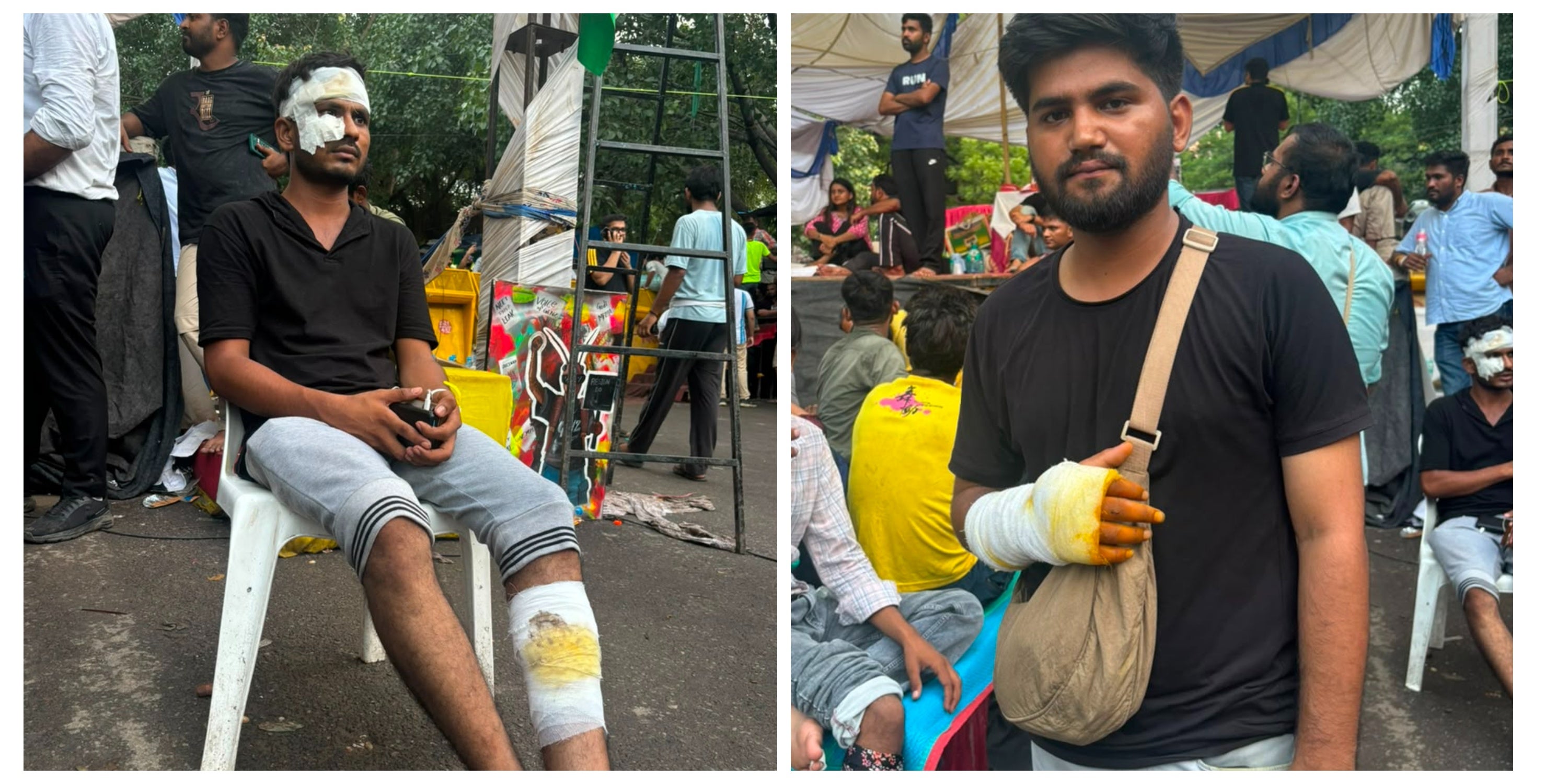 (L) Aniket Patil and Mayank were beaten by the police with batons at the New Delhi protest on 20 July 2026. (Alisha Rahaman Sarkar/ The Independent)