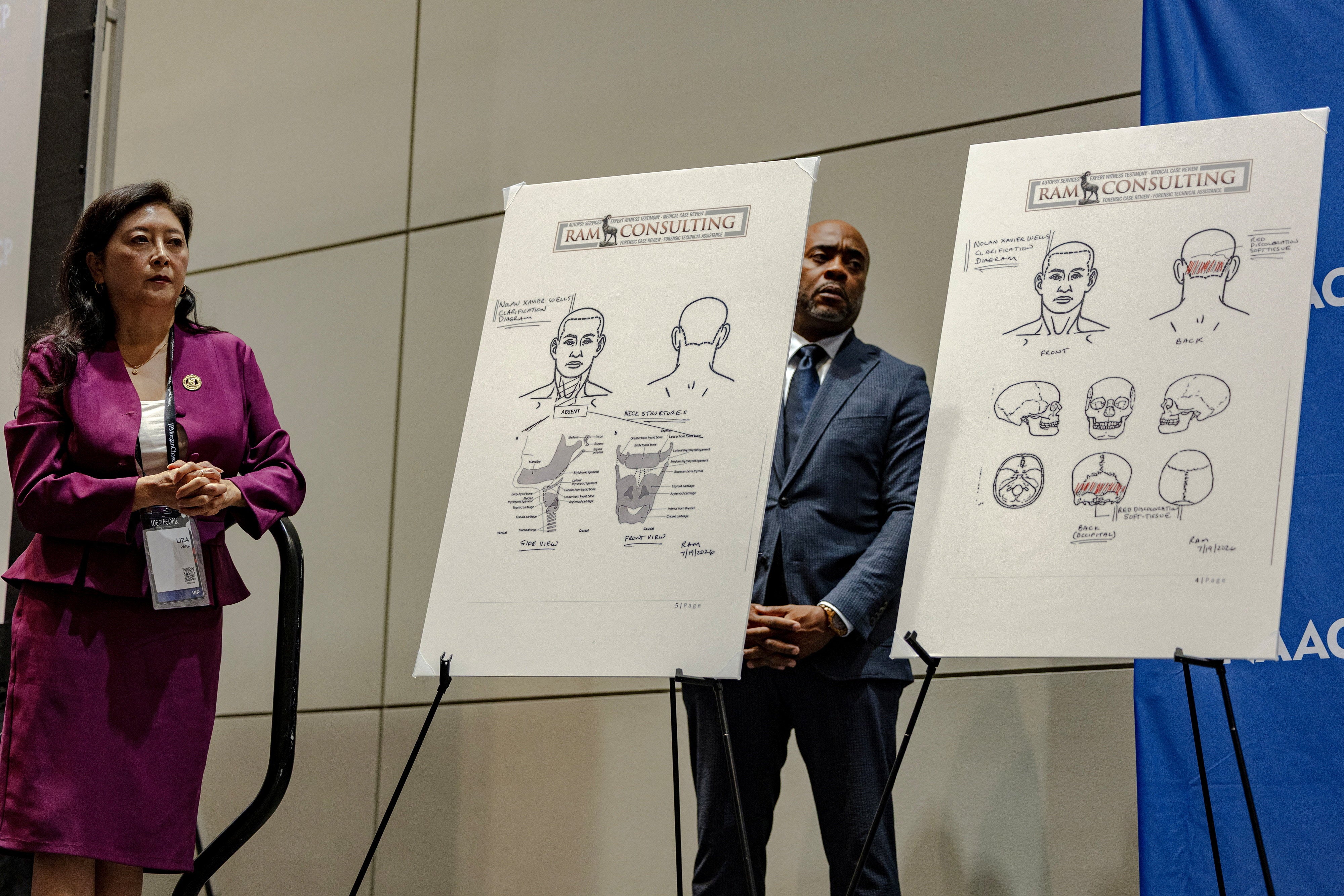 Without further information, the forensic pathologist, Dr. Roger Mitchell, wrote that he could not rule out the possibility that “non-accidental factors contributed to or caused the death