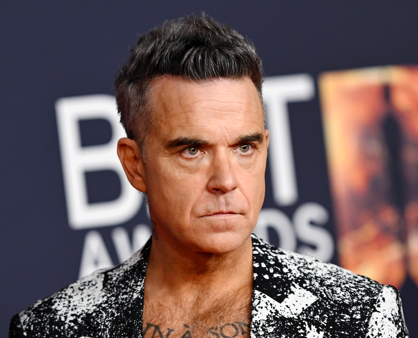 Robbie Williams hits out at claims he was ‘off his nut’ at World Cup after white lump gaffe – UK Times