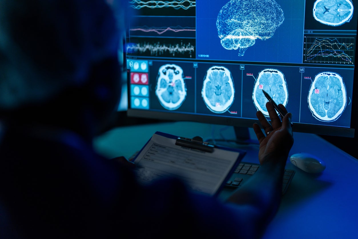 Breakthrough treatment possibilities for little-known brain condition that affects millions 