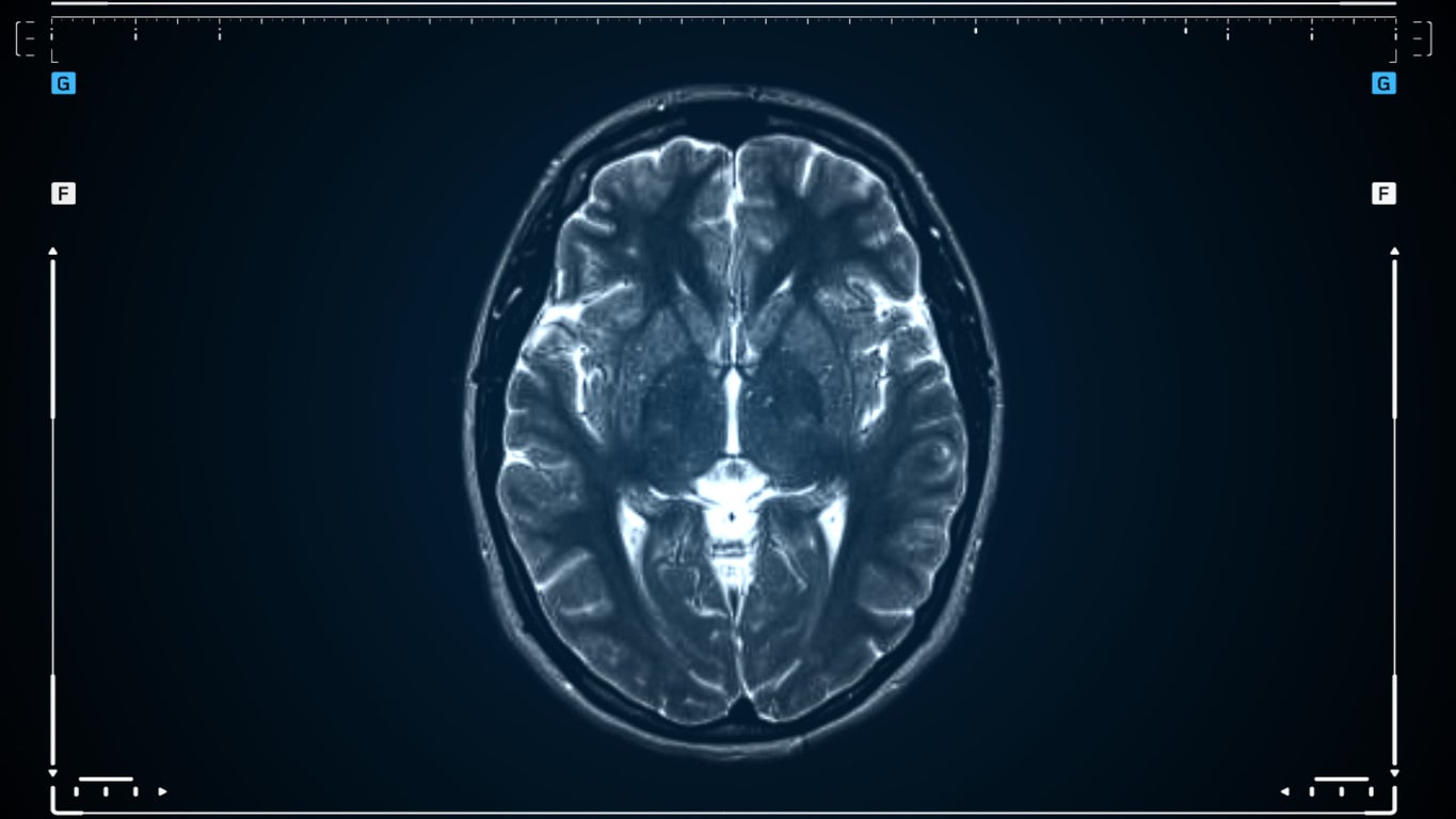 Latest research has found that the brain operated as two separate organs
