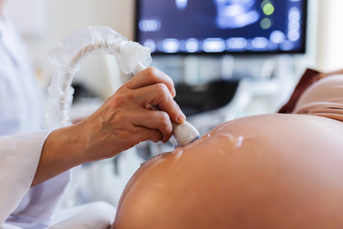 Ectopic Pregnancies Rise as Experts Cite Older Maternal Age
