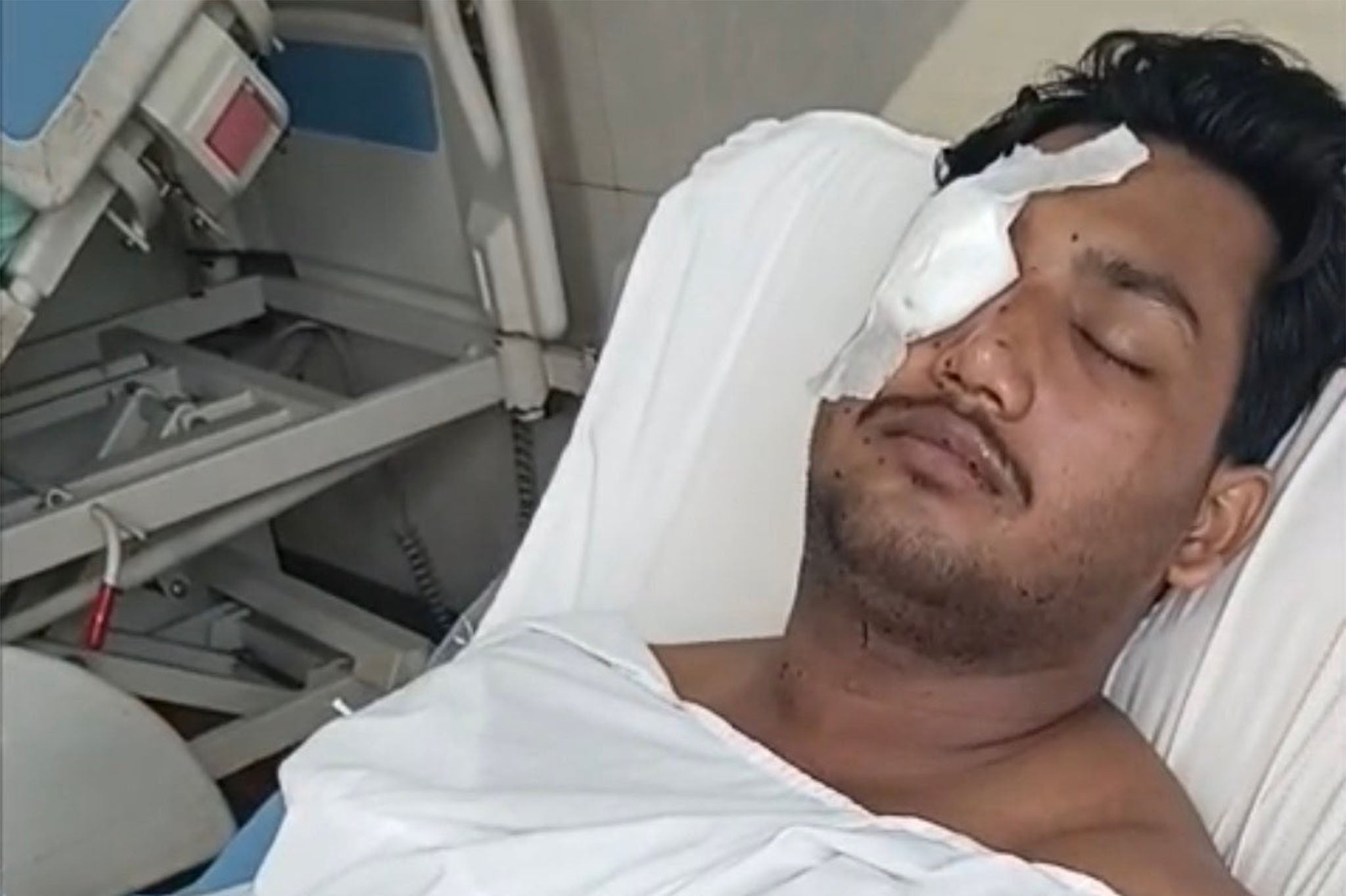 Sahil Lohchab suffered injury in his right eye