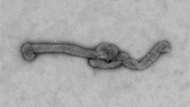 Das Bourbon-Virus ist ein RNA-Virus, das 2014 in Bourbon County, Kansas, entdeckt wurde