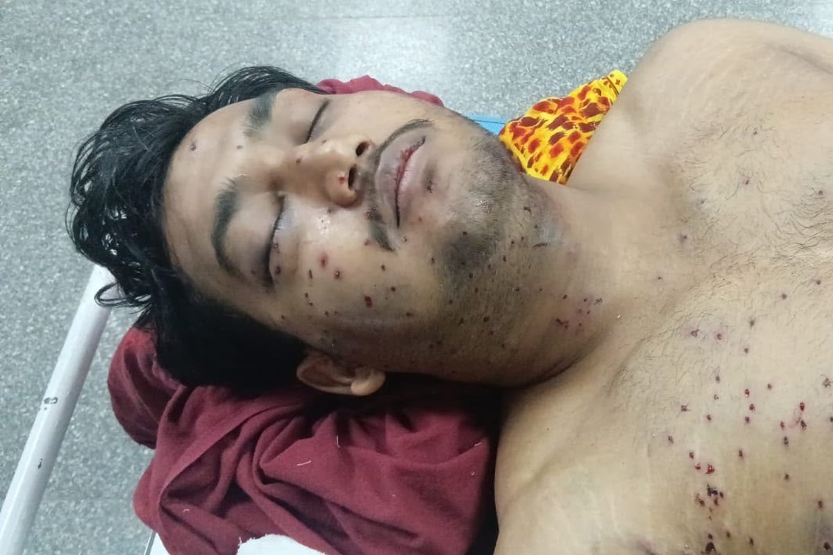 Indian authorities admit controversial ‘pellet gun’ used on protesters but blame rogue officer – UK Times Indian authorities admit controversial ‘pellet gun’ used on protesters but blame rogue officer – UK Times