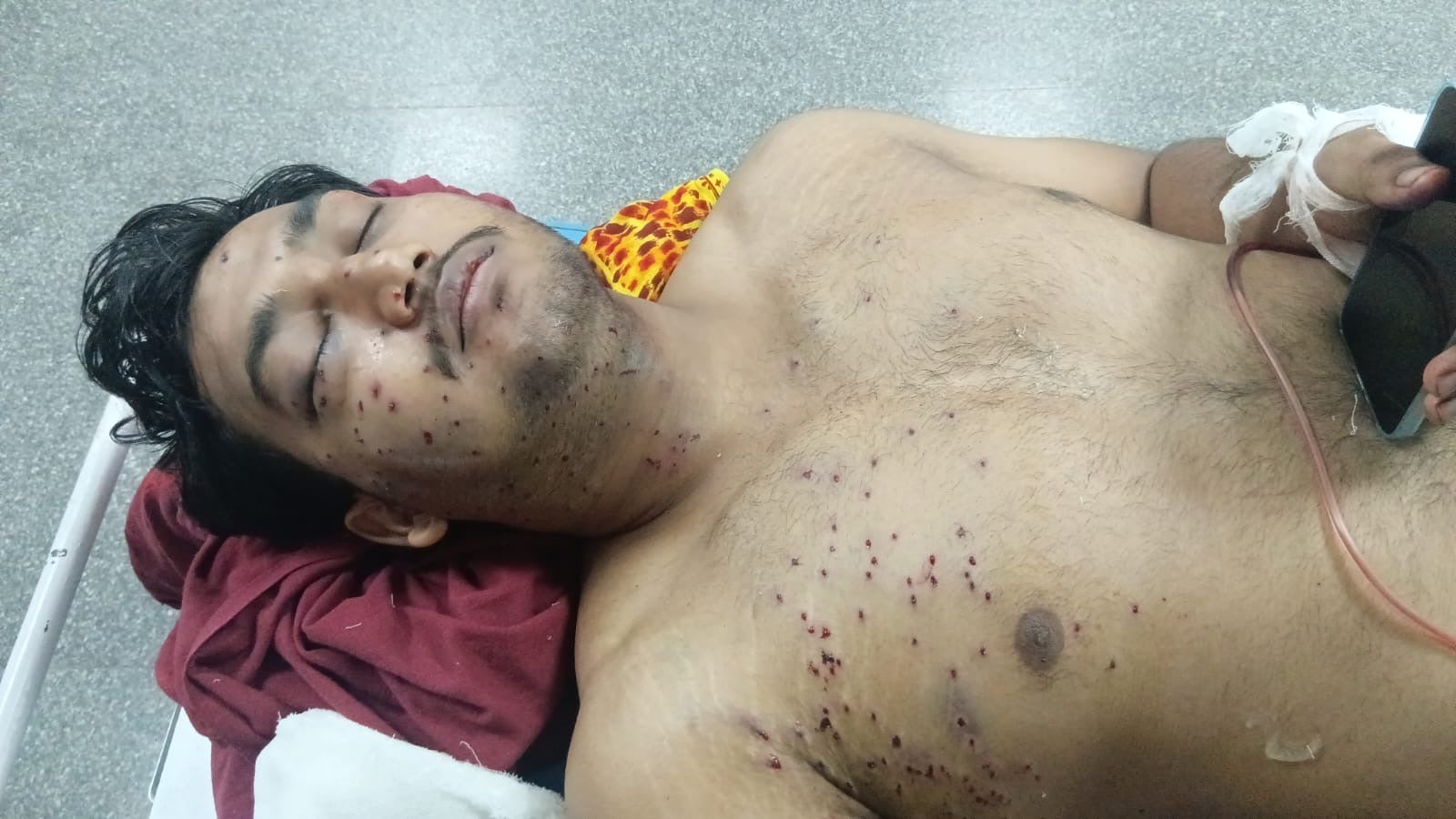 Sahil Lohchab’s friends and family says he only has a slim chance of regaining vision in his eye