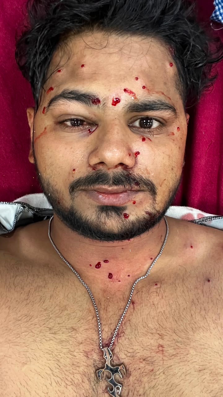 Irshad Sheikh Mansoori in a Delhi hospital