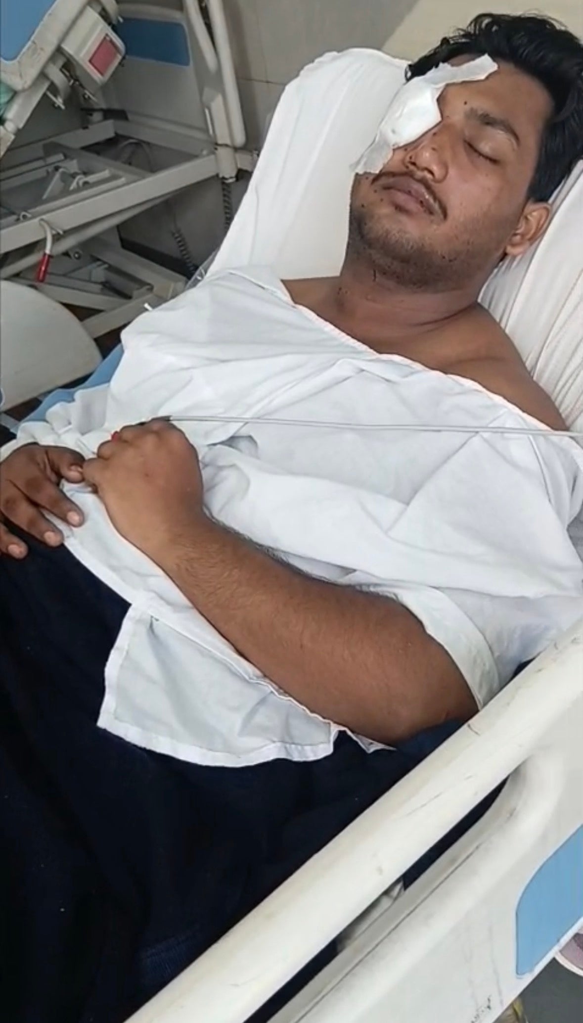Sahil Lohchab after surgery to remove pellets from his face and chest