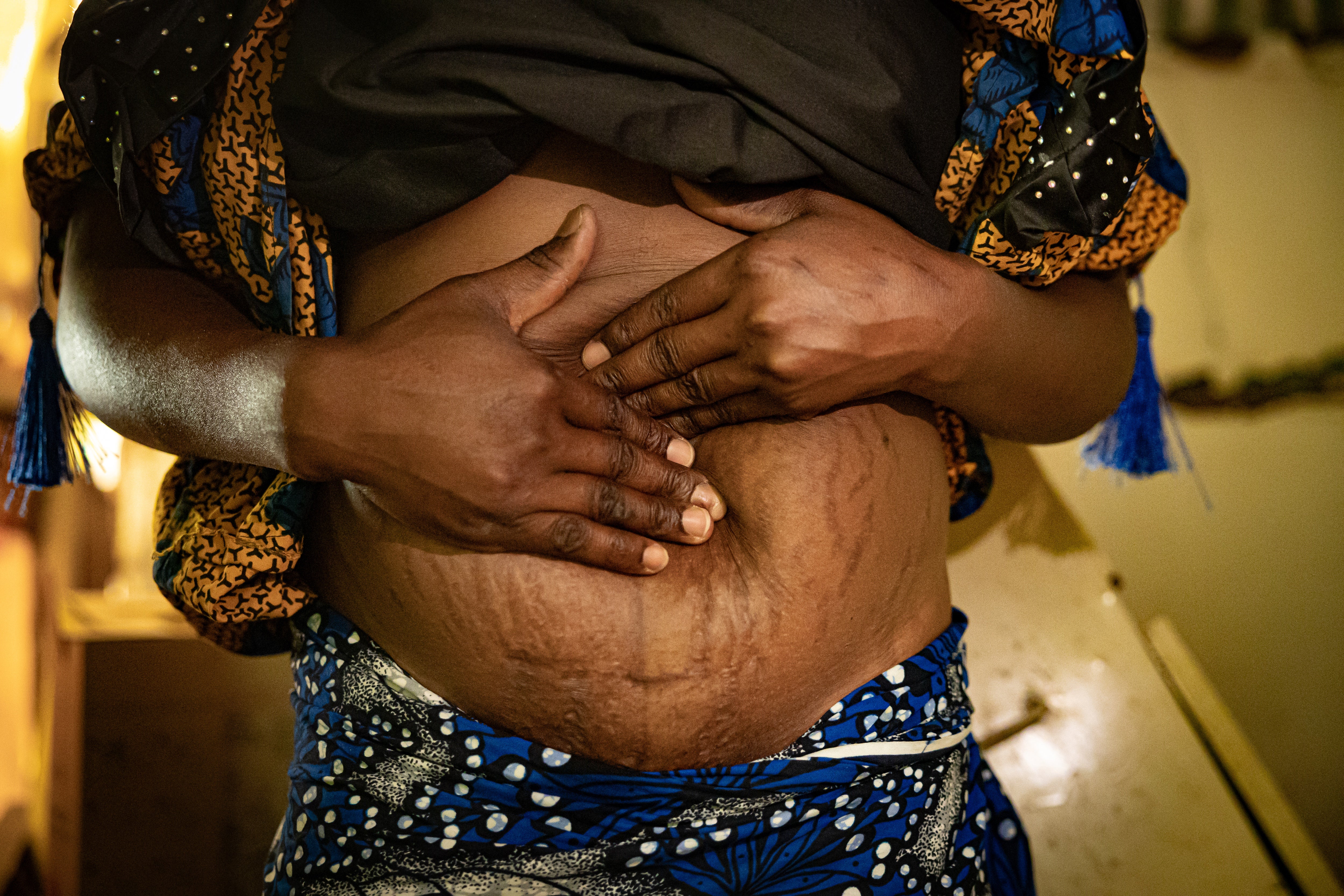 Blessing says she is still suffering from the aftermath of nearly dying giving birth - Nigeria