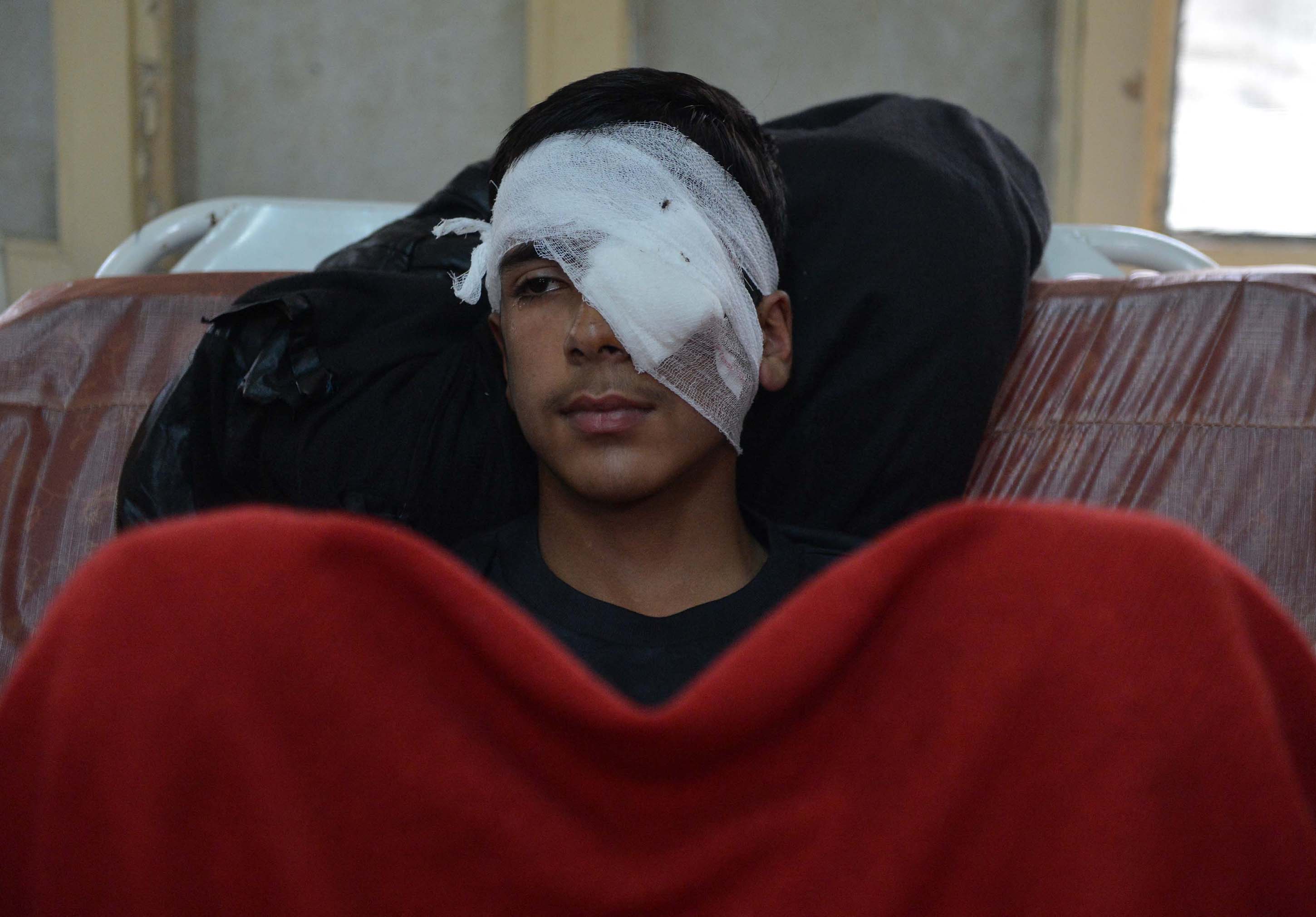 An Indian Kashmiri youth with an eye injury sits in a hospital after being hit by pellets fired by Indian security forces during a protest, in Srinagar on September 6, 2016