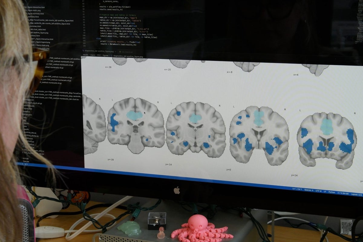 Poor sleep is doing more than making you tired – it’s changing the way your brain works – UK Times Poor sleep is doing more than making you tired – it’s changing the way your brain works – UK Times
