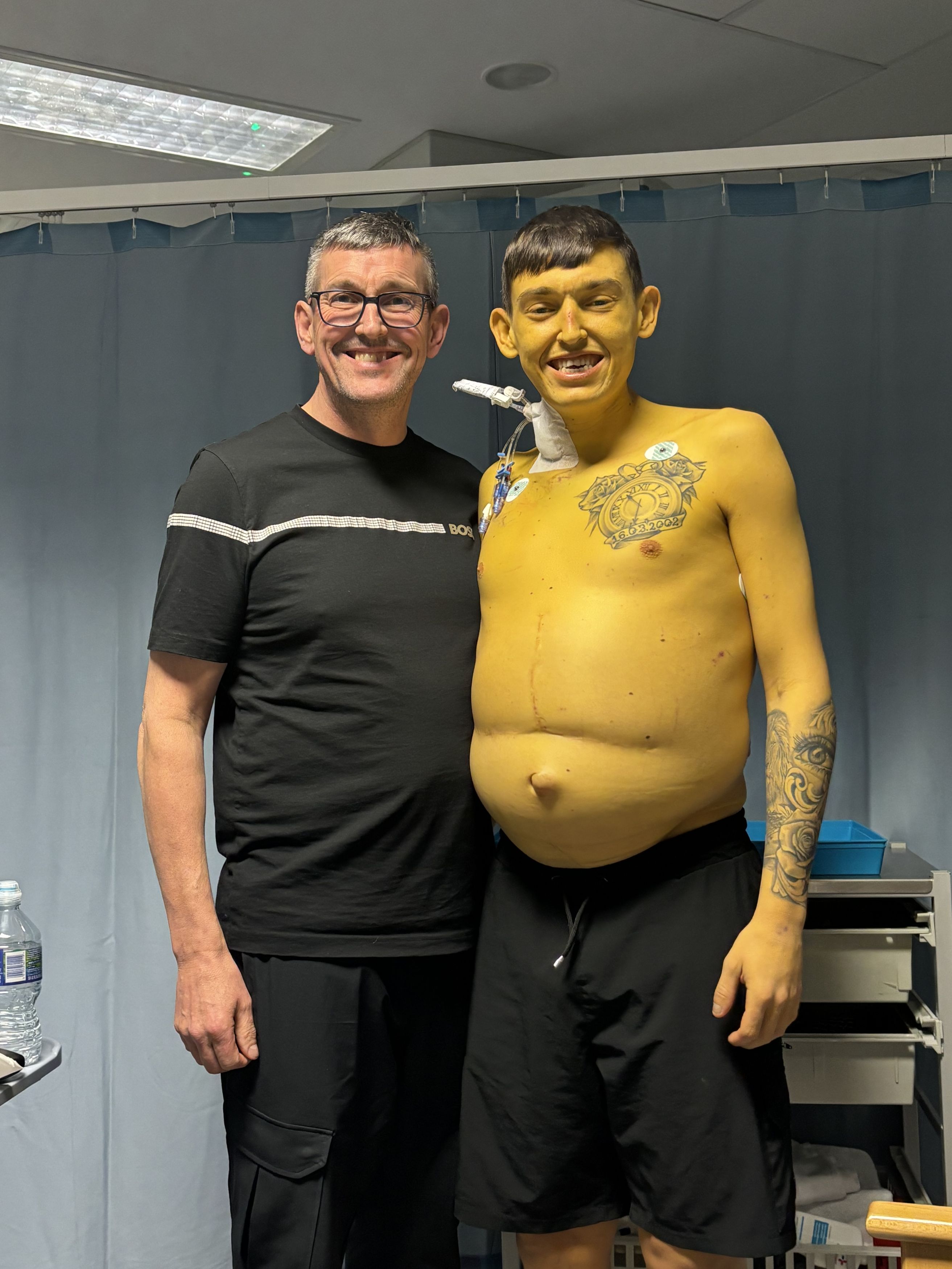 Cheshire man turns bright yellow &lsquo;like Bart Simpson&rsquo; due to rare, life-threatening disease