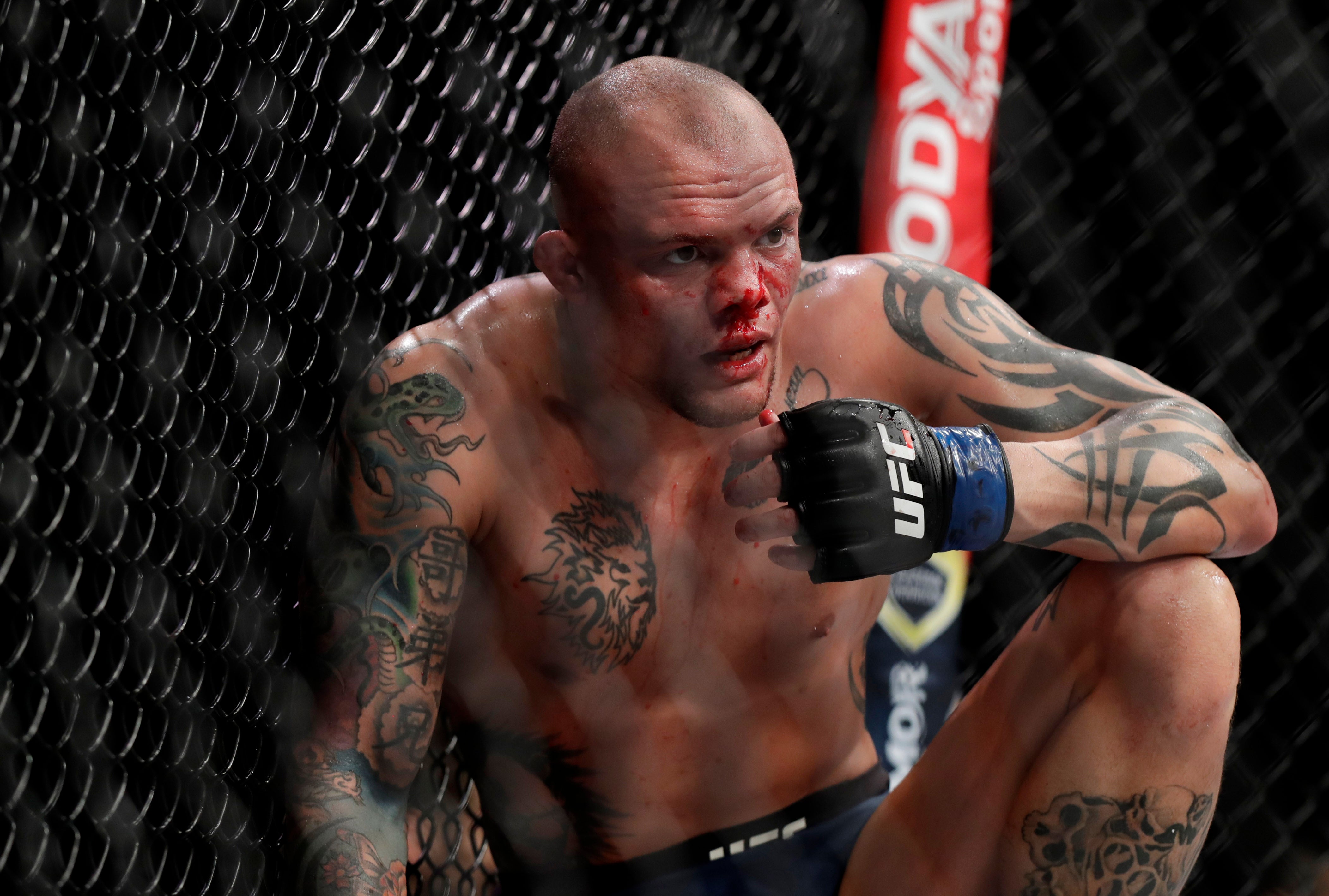 Former UFC title challenger Anthony Smith arrested on felony charges