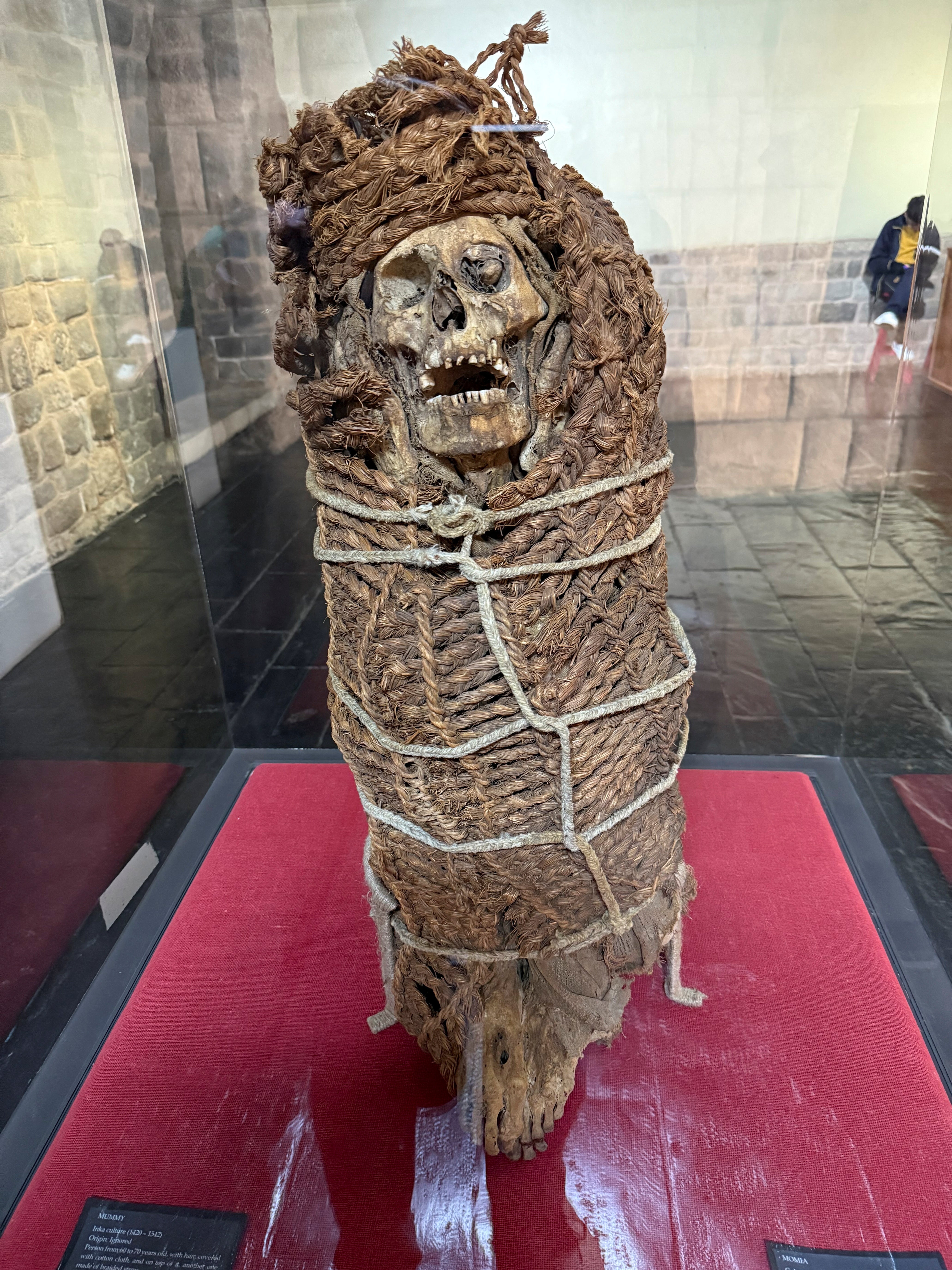 Researchers found evidence of two smallpox infections in ancient DNA from the leg bone fragments of an adult man and woman