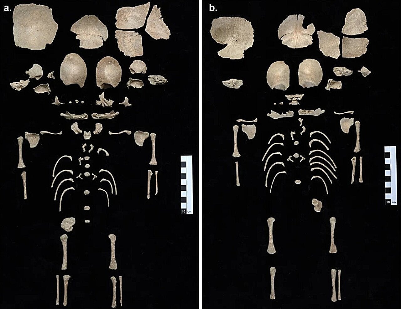 Bones from the two infants