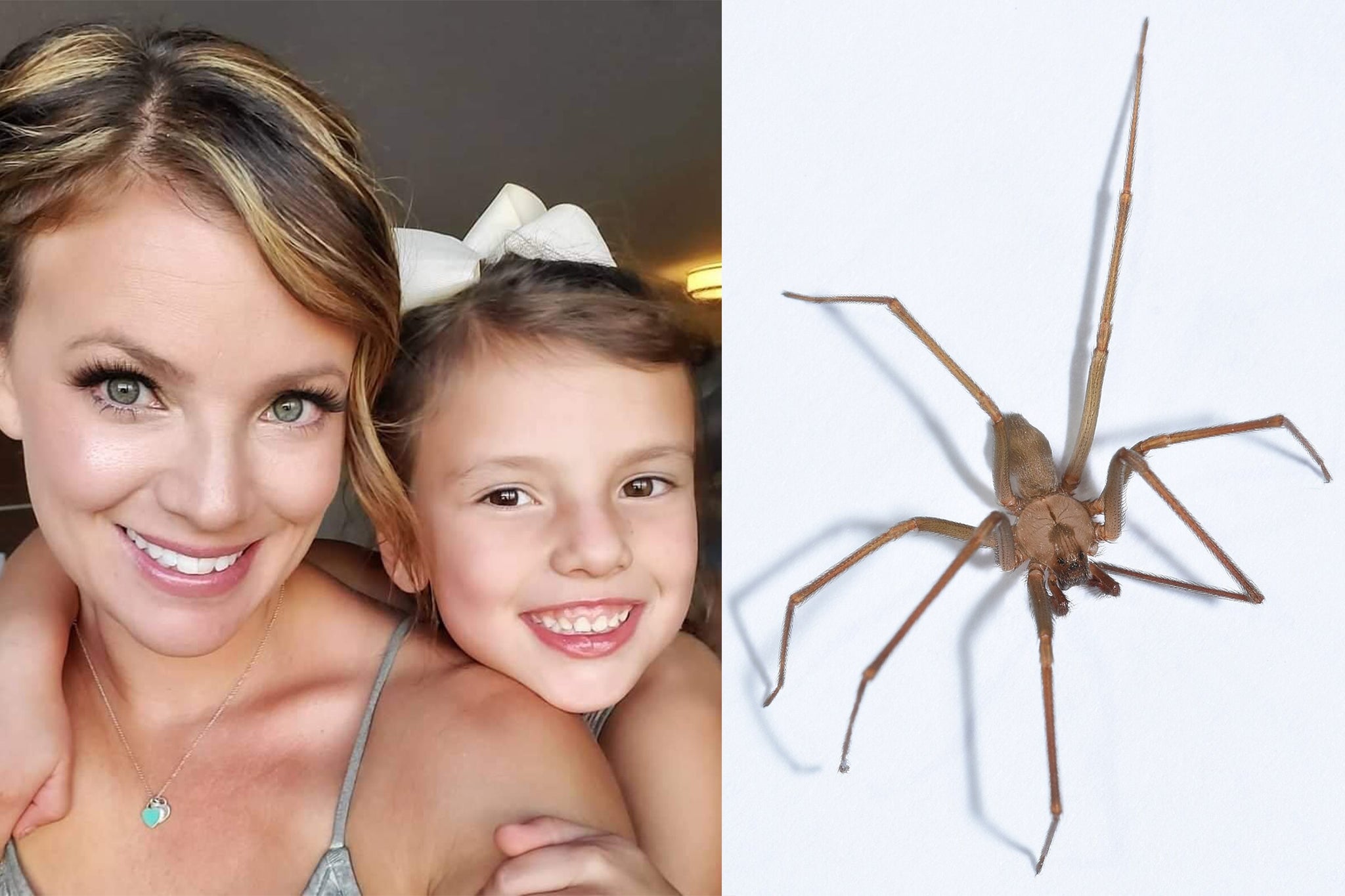 Kansas woman hospitalized following unidentified spider bite