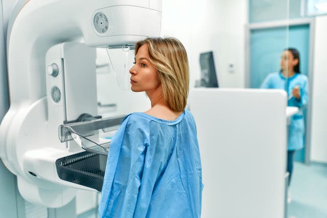 Breast cancer is the most common cause of cancer-related death in women aged 35 to 64 in the UK