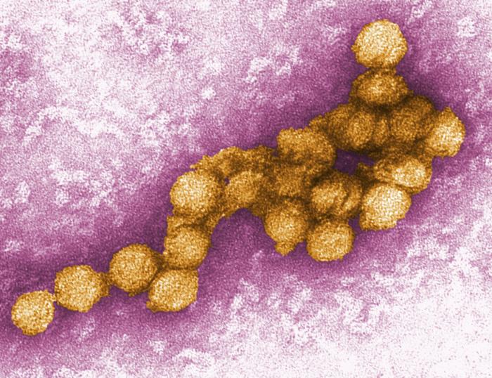 The West Nile virus is seen under a microscope. Severe infections can lead to paralysis, coma, vision loss and spine and brain inflammation