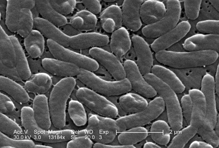 A grouping of Vibrio vulnificus bacteria is seen in this scanning electron microscopic image. The bacteria thrives in warmer waters