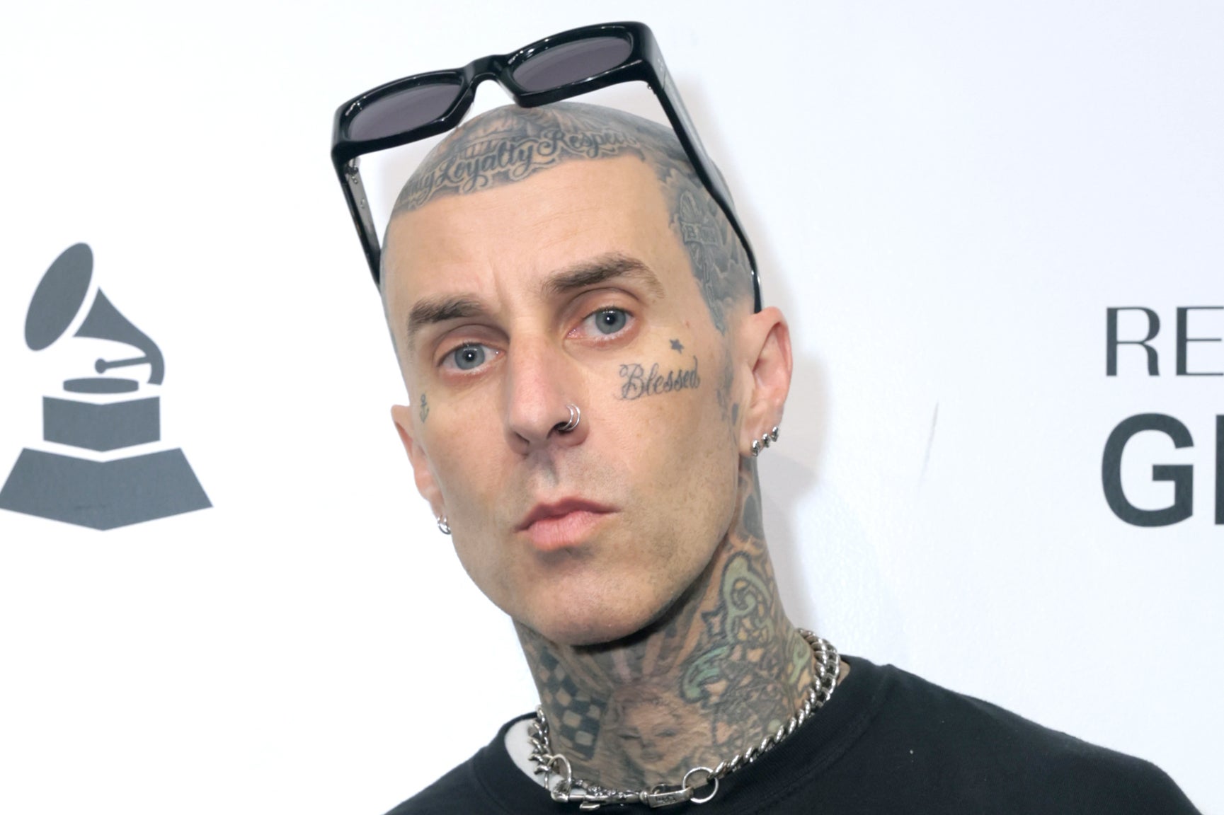 Travis Barker shares harrowing new details about plane crash: &lsquo;65% of my body was burned&rsquo;